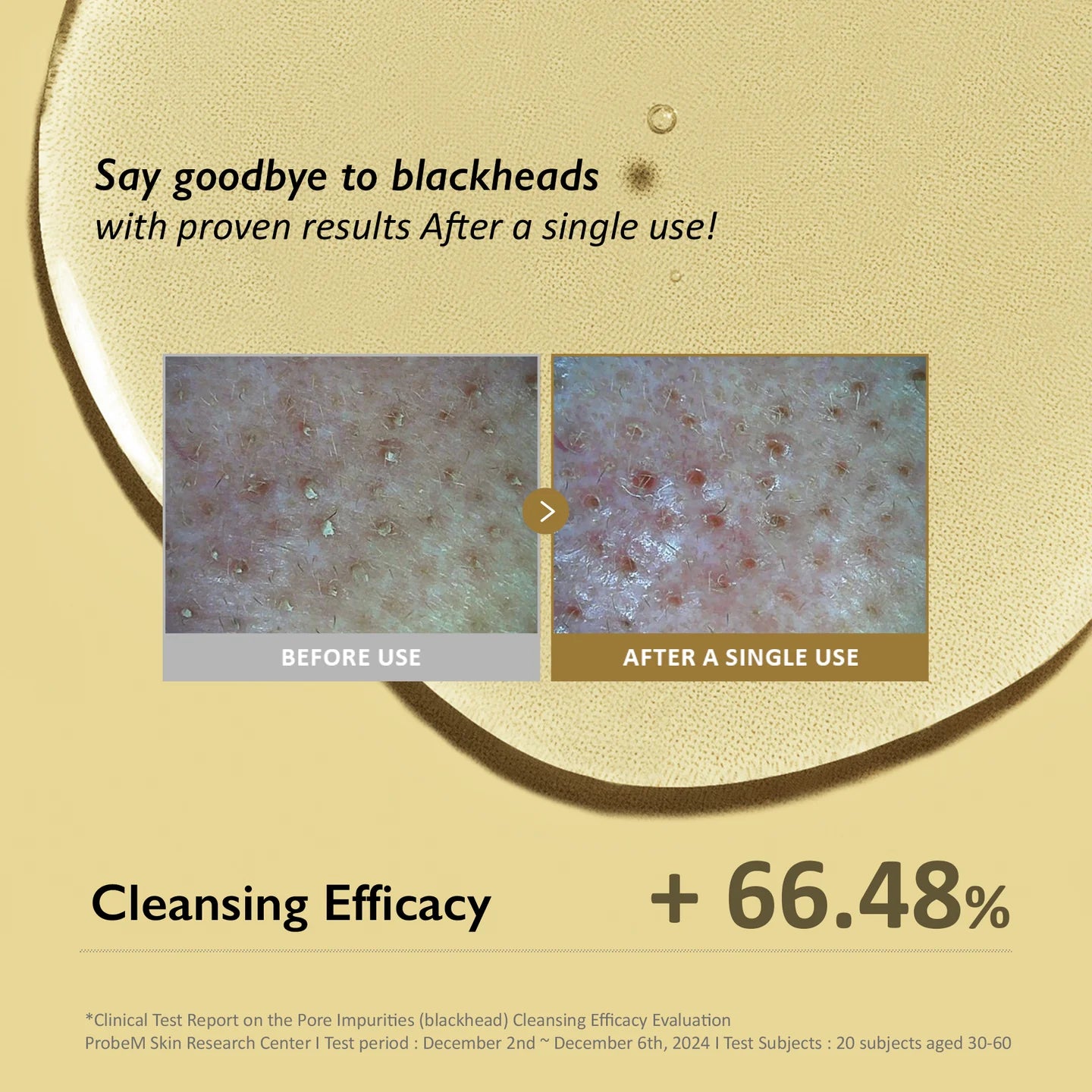 Haruharu Wonder Black Rice Moisture Deep Cleansing Oil 150ml – Hydrating Gentle Makeup Remover